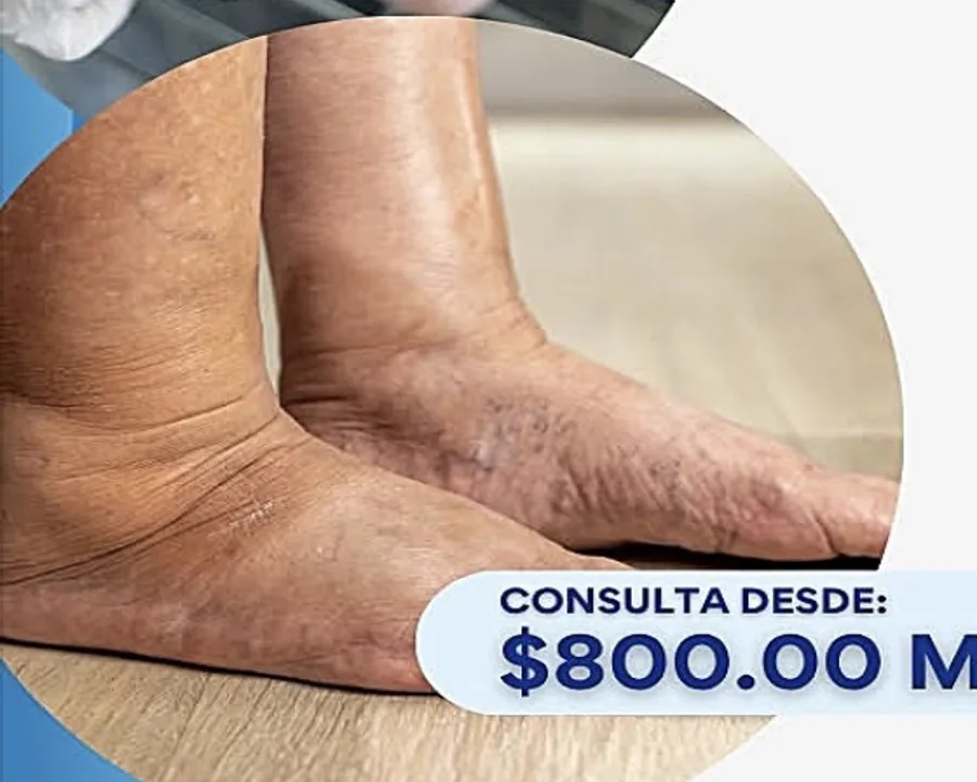Valoración y cuidado de pie diabético