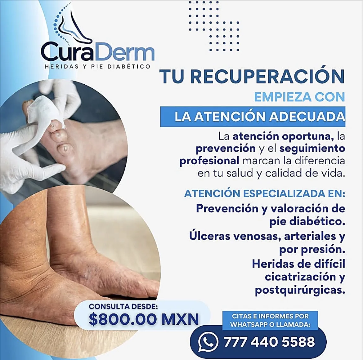 Promoción de servicios CuraDerm
